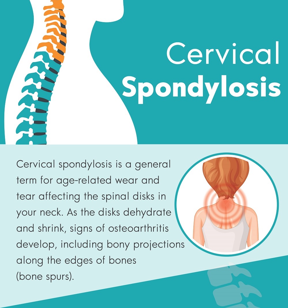 symptoms of spondylolisthesis cervical